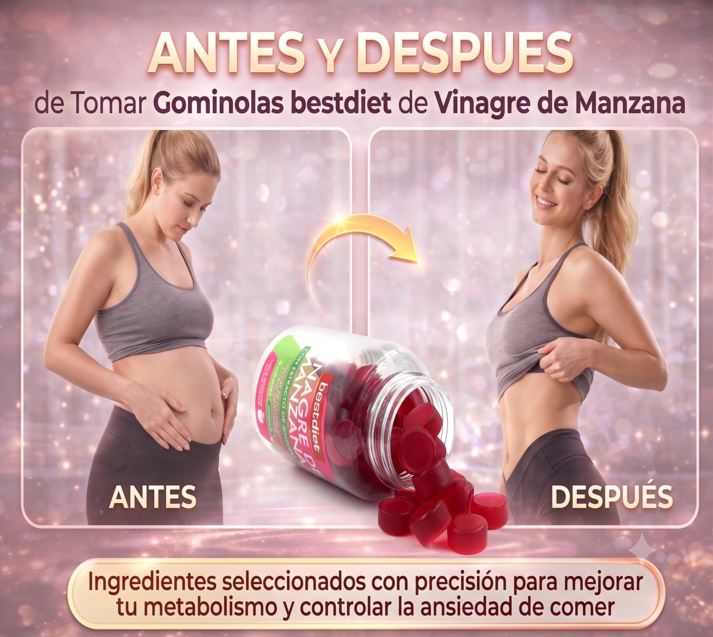 Gummies de Vinagre de Manzana SUP